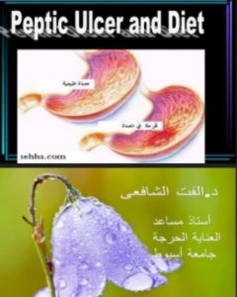 قرحة المعدة والتغذية
